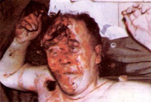 Bildquelle: 4International Die Leiche des bosnisch-serbischen Zivilisten Radivoje Lukic, 59. Der von der bosnisch-muslimischen paramilitärischen Einheit " Dzamijski Golubovi", am 08.10.1992 in Klisa mit einer Axt in ermordet wurde.  