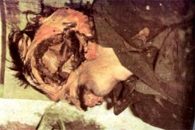 Bildquelle: 4International Sarajevo: Der Körper des bosnischen Serben Nenad Beribaka. Bosnisch-muslimische Kräfte verstümmelten seinen Körper, nachdem sie ihn durch Extraktion des Gehirns getötet haben 
