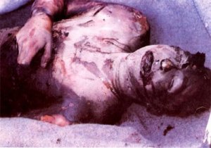 Bildquelle: 4International Die getötete verstümmelte Leiche des Velo Majstorovic der  in Milici in Ostbosnien, südwestlich von Srebrenica der von bosnisch-muslimischen Kräften gefoltert, beschnitten und lebendig verbrannt wurde 